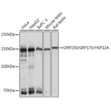 Western Blot - Anti-ORP150 Antibody [ARC1857] (A306853) - Antibodies.com