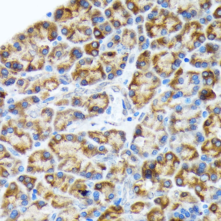 Immunohistochemistry - Anti-ORP150 Antibody [ARC1857] (A306853) - Antibodies.com