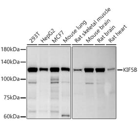 Western Blot - Anti-KIF5B Antibody [ARC2904] (A306854) - Antibodies.com