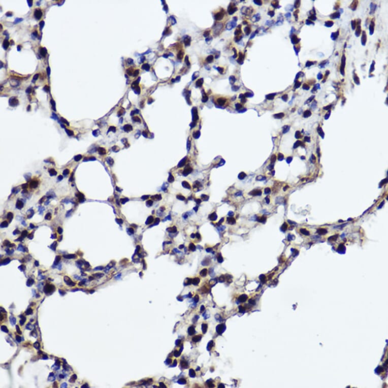 Immunohistochemistry - Anti-RanBP3 Antibody [ARC2496] (A306855) - Antibodies.com