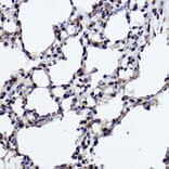 Immunohistochemistry - Anti-RanBP3 Antibody [ARC2496] (A306855) - Antibodies.com