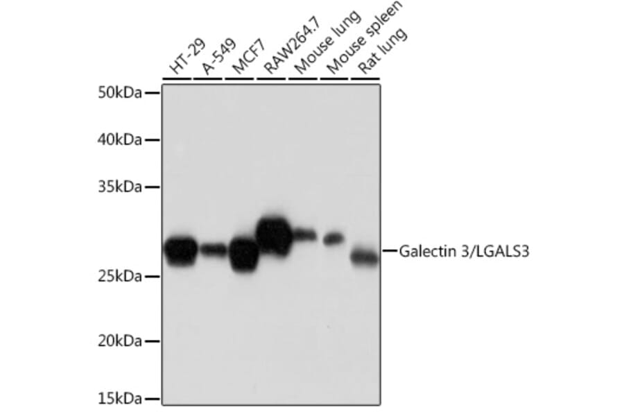 Western Blot - Anti-Galectin 3 Antibody [ARC0542] (A306857) - Antibodies.com