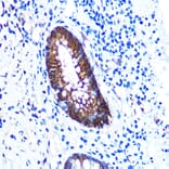 Immunohistochemistry - Anti-Galectin 3 Antibody [ARC0542] (A306857) - Antibodies.com
