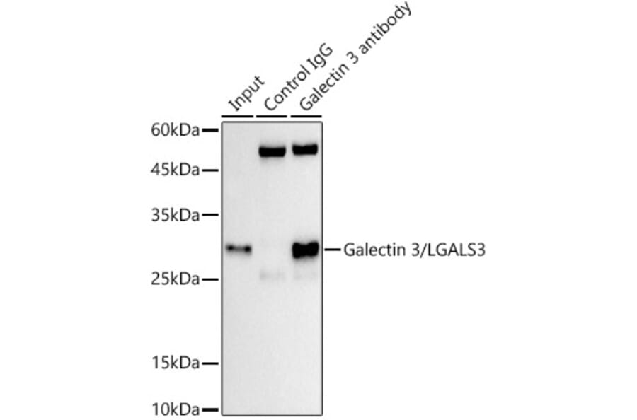 Western Blot - Anti-Galectin 3 Antibody [ARC0542] (A306857) - Antibodies.com