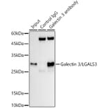 Western Blot - Anti-Galectin 3 Antibody [ARC0542] (A306857) - Antibodies.com