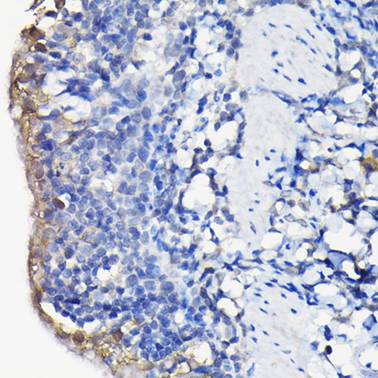 Immunohistochemistry - Anti-Galectin 3 Antibody (A306858) - Antibodies.com