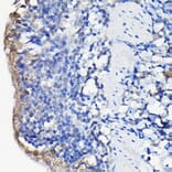 Immunohistochemistry - Anti-Galectin 3 Antibody (A306858) - Antibodies.com