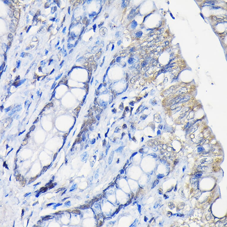 Immunohistochemistry - Anti-Galectin 3 Antibody (A306858) - Antibodies.com