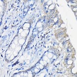 Immunohistochemistry - Anti-Galectin 3 Antibody (A306858) - Antibodies.com