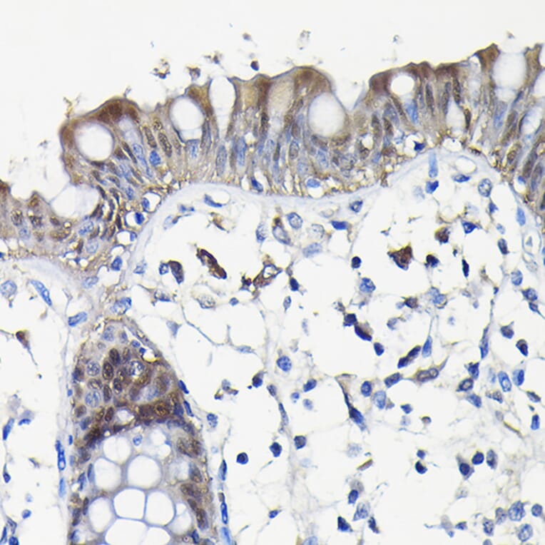 Immunohistochemistry - Anti-Galectin 3 Antibody (A306858) - Antibodies.com