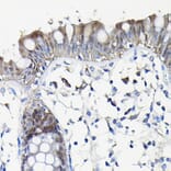 Immunohistochemistry - Anti-Galectin 3 Antibody (A306858) - Antibodies.com