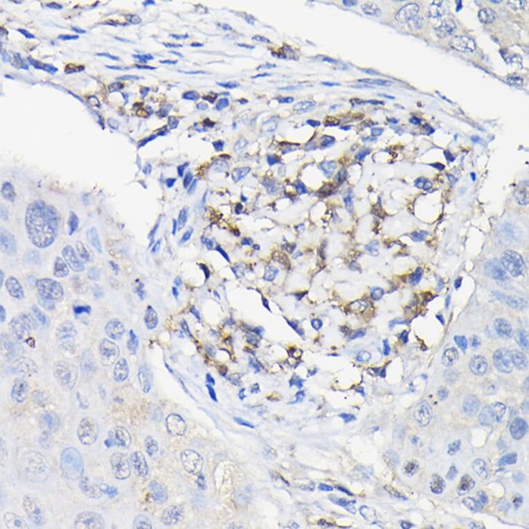 Immunohistochemistry - Anti-Galectin 3 Antibody (A306858) - Antibodies.com