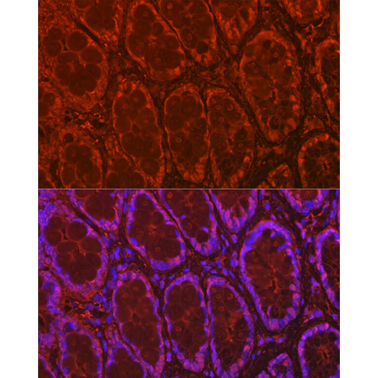 Immunofluorescence - Anti-Galectin 3 Antibody (A306858) - Antibodies.com