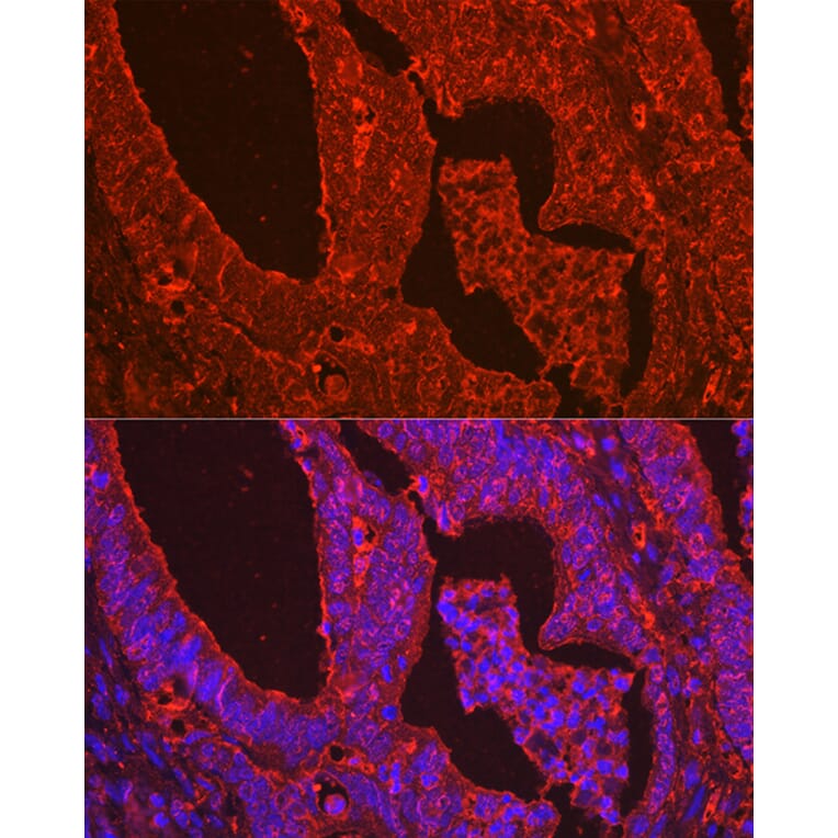 Immunofluorescence - Anti-Galectin 3 Antibody (A306858) - Antibodies.com