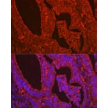 Immunofluorescence - Anti-Galectin 3 Antibody (A306858) - Antibodies.com