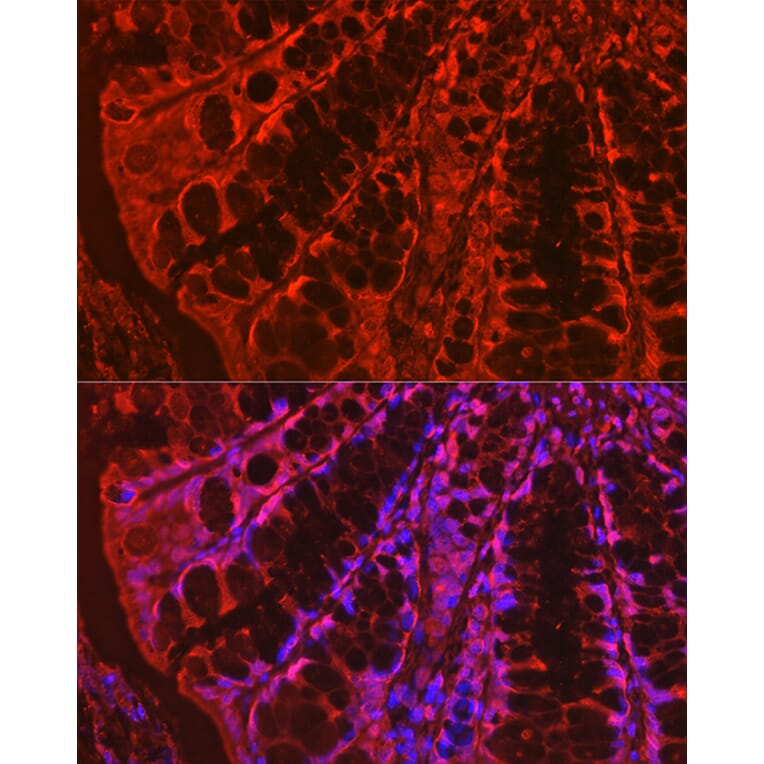 Immunofluorescence - Anti-Galectin 3 Antibody (A306858) - Antibodies.com