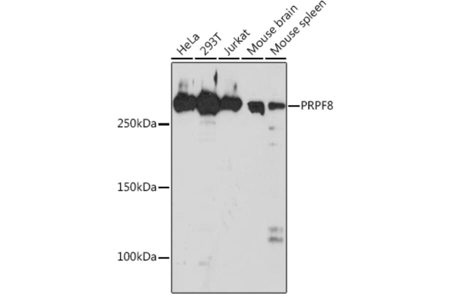 Western Blot - Anti-PRPF8/Prp8 Antibody [ARC1038] (A306859) - Antibodies.com