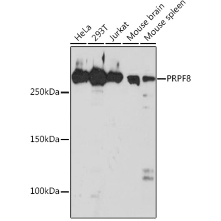 Western Blot - Anti-PRPF8/Prp8 Antibody [ARC1038] (A306859) - Antibodies.com