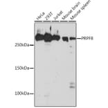 Western Blot - Anti-PRPF8/Prp8 Antibody [ARC1038] (A306859) - Antibodies.com