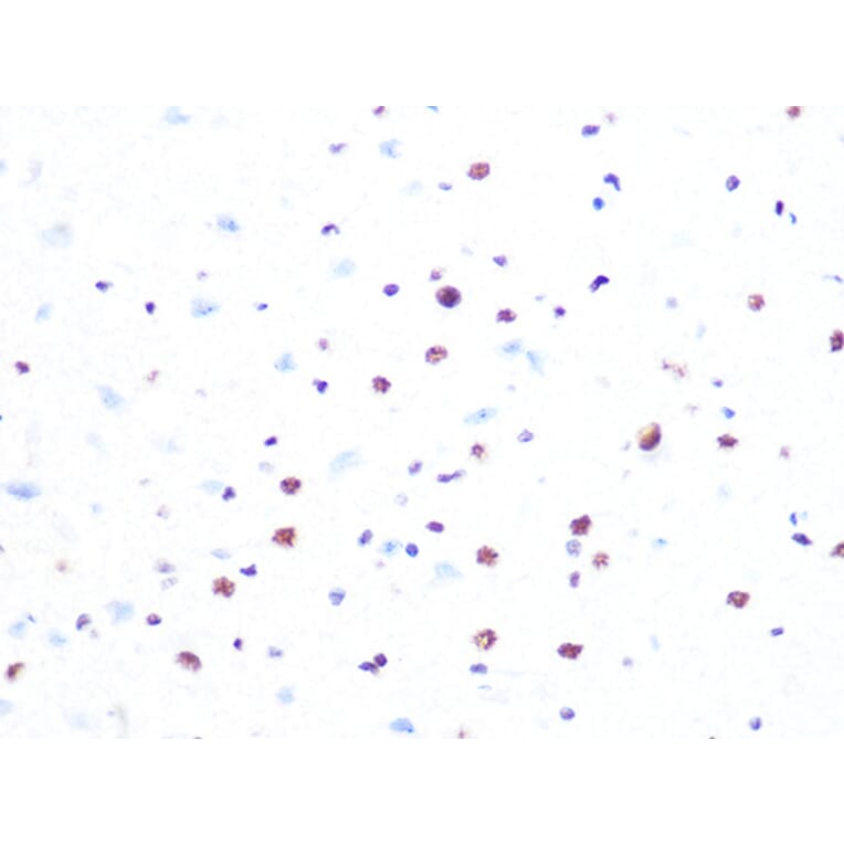 Immunohistochemistry - Anti-PRPF8/Prp8 Antibody [ARC1038] (A306859) - Antibodies.com