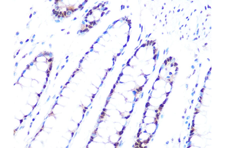 Immunohistochemistry - Anti-PRPF8/Prp8 Antibody [ARC1038] (A306859) - Antibodies.com