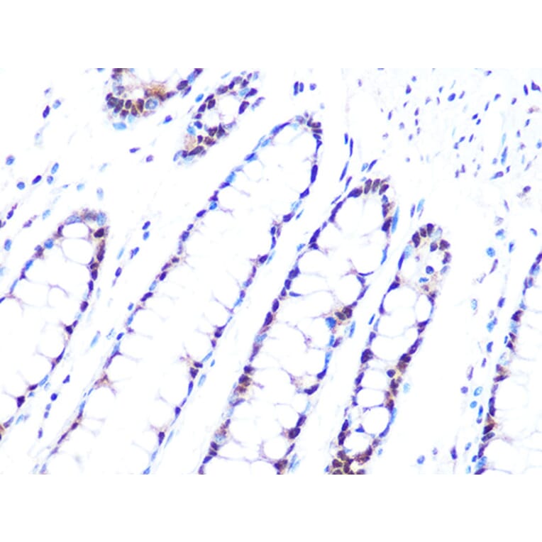 Immunohistochemistry - Anti-PRPF8/Prp8 Antibody [ARC1038] (A306859) - Antibodies.com