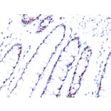 Immunohistochemistry - Anti-PRPF8/Prp8 Antibody [ARC1038] (A306859) - Antibodies.com