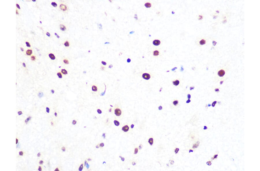 Immunohistochemistry - Anti-PRPF8/Prp8 Antibody [ARC1038] (A306859) - Antibodies.com