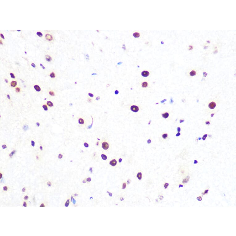 Immunohistochemistry - Anti-PRPF8/Prp8 Antibody [ARC1038] (A306859) - Antibodies.com