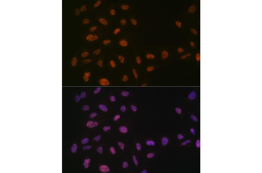 Immunofluorescence - Anti-PRPF8/Prp8 Antibody [ARC1038] (A306859) - Antibodies.com