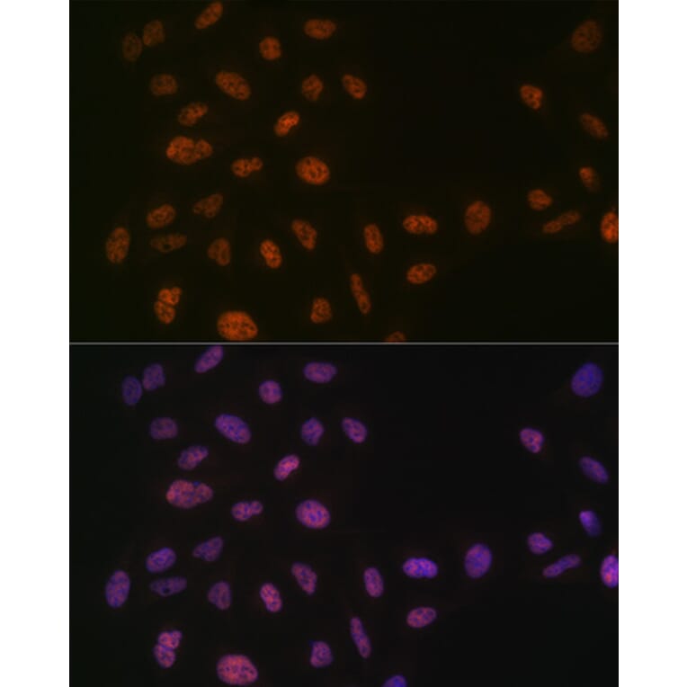 Immunofluorescence - Anti-PRPF8/Prp8 Antibody [ARC1038] (A306859) - Antibodies.com