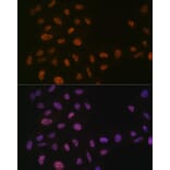 Immunofluorescence - Anti-PRPF8/Prp8 Antibody [ARC1038] (A306859) - Antibodies.com