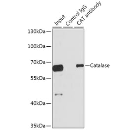 Western Blot - Anti-Catalase Antibody (A306861) - Antibodies.com