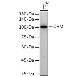 Western Blot - Anti-CHM Antibody [ARC2736] (A306862) - Antibodies.com