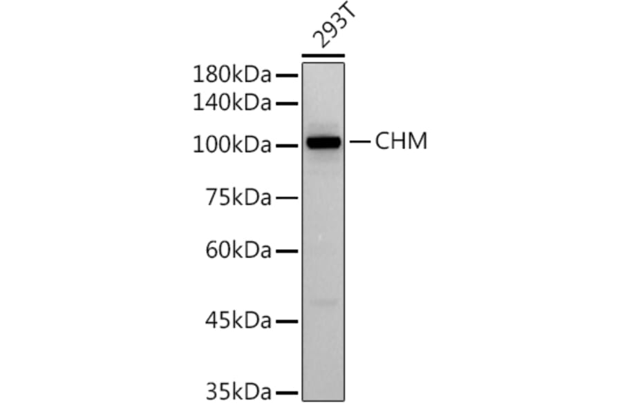 Western Blot - Anti-CHM Antibody [ARC2736] (A306862) - Antibodies.com