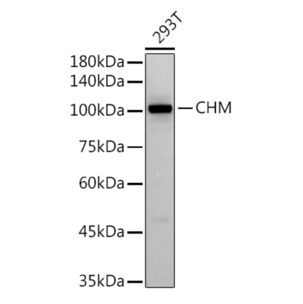 Western Blot - Anti-CHM Antibody [ARC2736] (A306862) - Antibodies.com