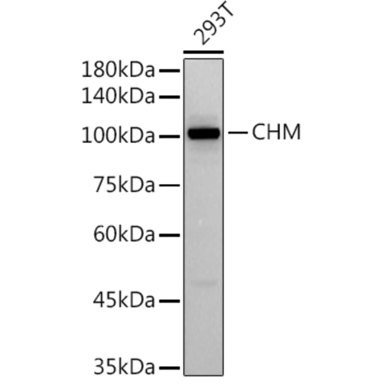 Western Blot - Anti-CHM Antibody [ARC2736] (A306862) - Antibodies.com