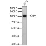 Western Blot - Anti-CHM Antibody [ARC2736] (A306862) - Antibodies.com