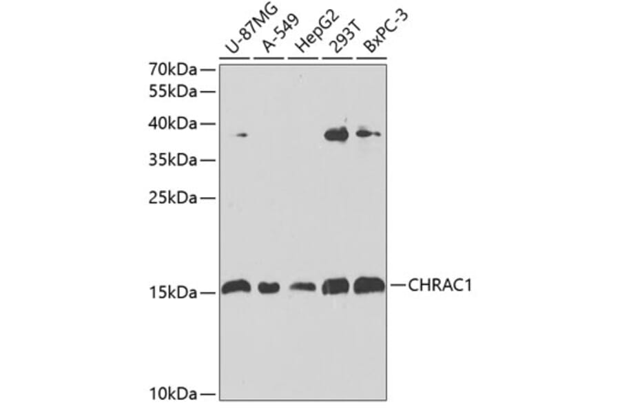 Western Blot - Anti-CHRAC1 Antibody (A306864) - Antibodies.com