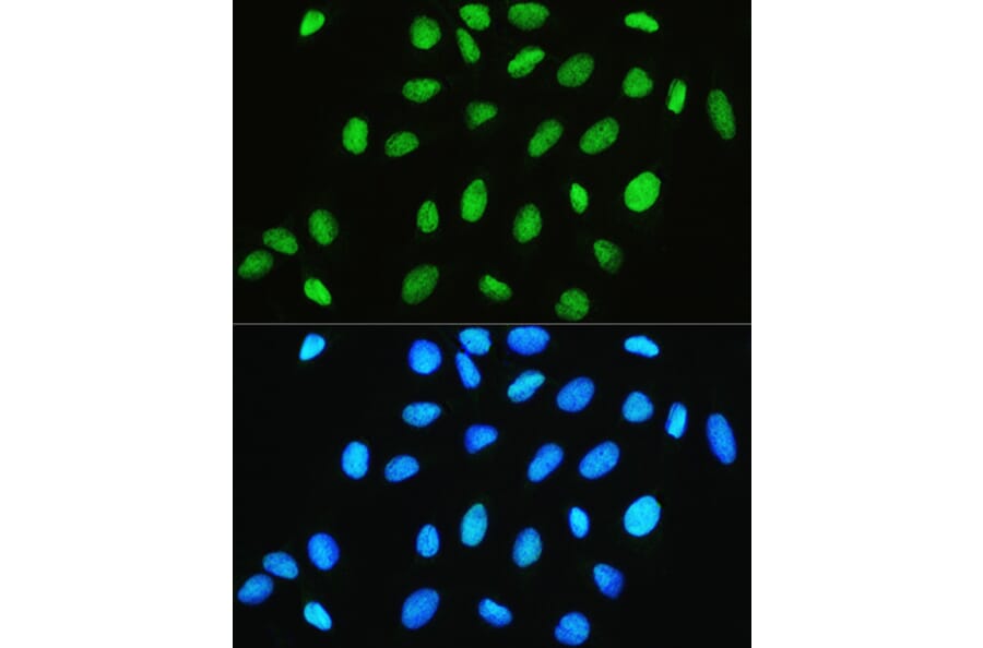Immunofluorescence - Anti-CHRAC1 Antibody (A306864) - Antibodies.com