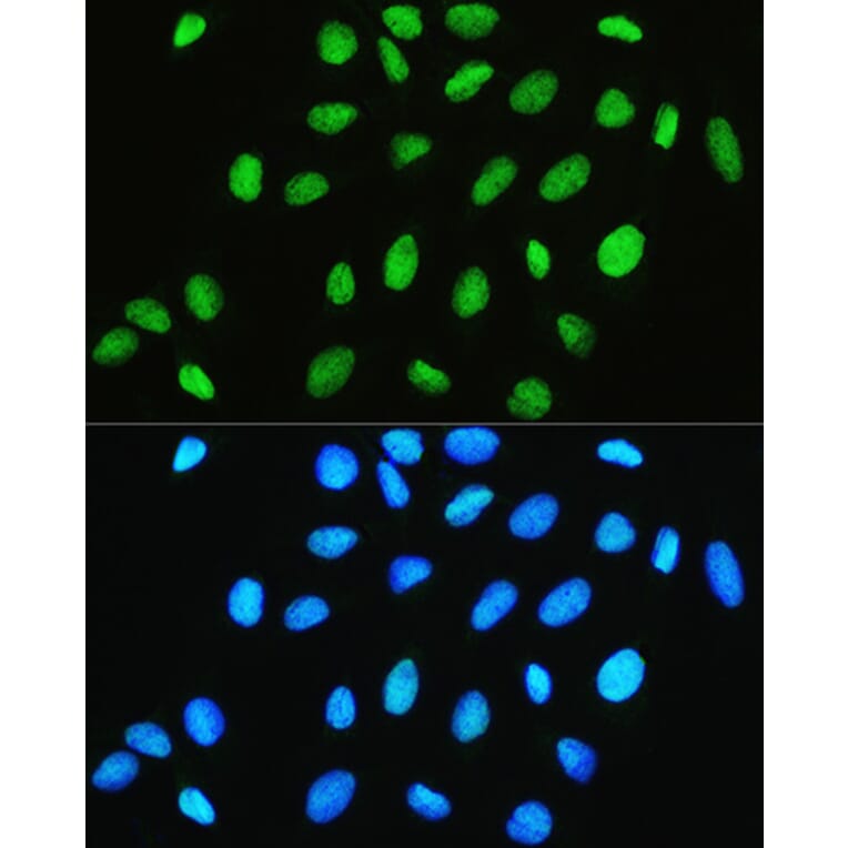 Immunofluorescence - Anti-CHRAC1 Antibody (A306864) - Antibodies.com