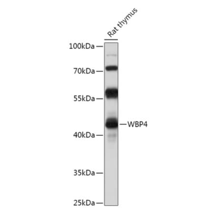 Western Blot - Anti-WW domain binding protein 4 Antibody (A306865) - Antibodies.com