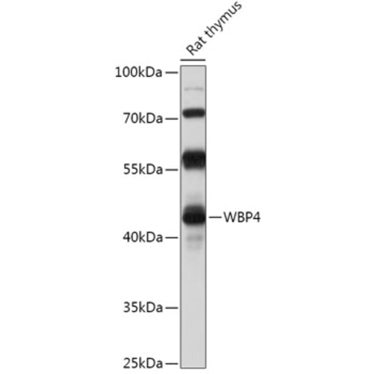 Western Blot - Anti-WW domain binding protein 4 Antibody (A306865) - Antibodies.com