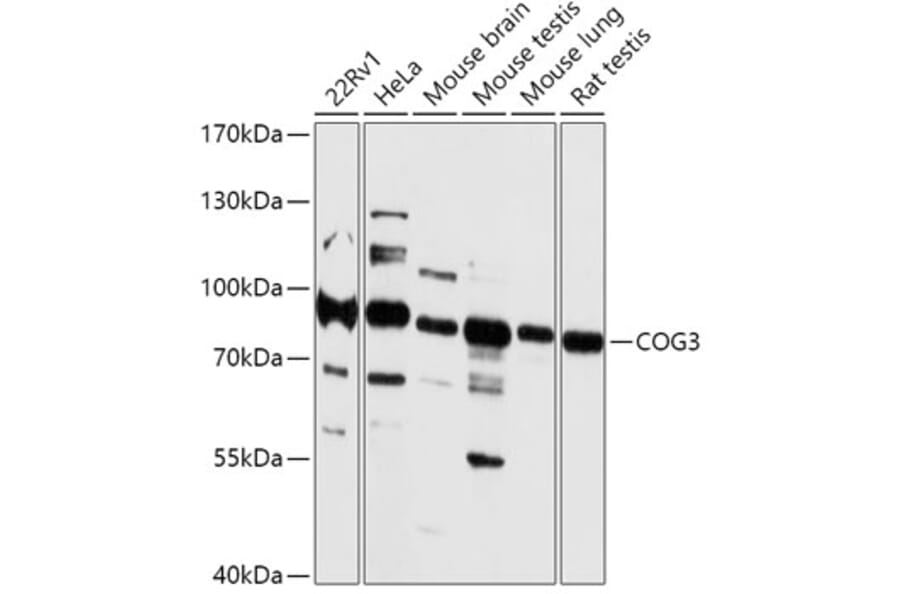 Western Blot - Anti-COG3 Antibody (A306866) - Antibodies.com