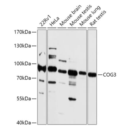 Western Blot - Anti-COG3 Antibody (A306866) - Antibodies.com