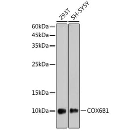 Western Blot - Anti-COX6B1 Antibody [ARC2568] (A306867) - Antibodies.com