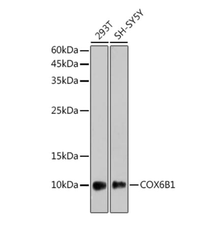 Western Blot - Anti-COX6B1 Antibody [ARC2568] (A306867) - Antibodies.com