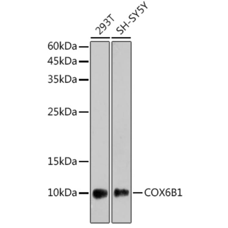 Western Blot - Anti-COX6B1 Antibody [ARC2568] (A306867) - Antibodies.com