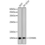 Western Blot - Anti-COX6B1 Antibody [ARC2568] (A306867) - Antibodies.com