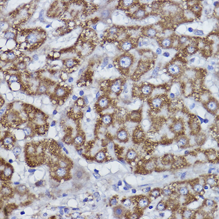 Immunohistochemistry - Anti-COX6B1 Antibody [ARC2568] (A306867) - Antibodies.com